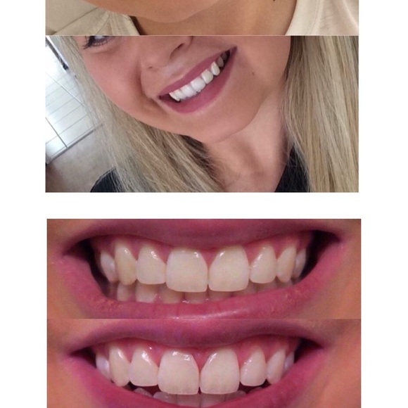 Nuskin Toothpaste - Picture 3 of 3